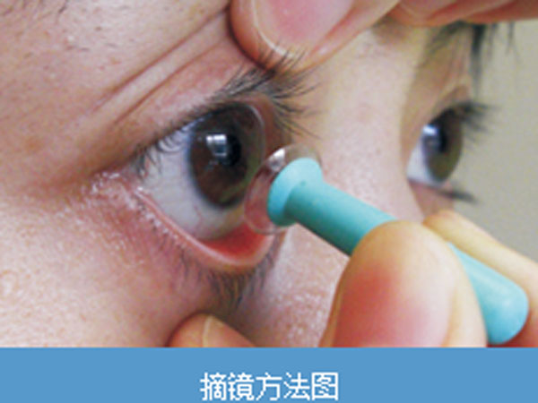 欧唯视眼科